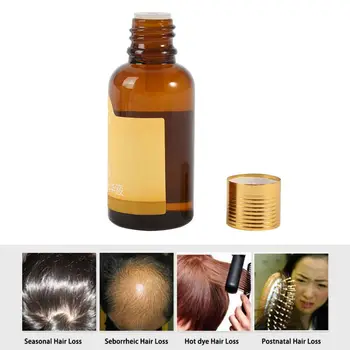 Najnovšie 30ml Muži Ženy Vlasy Starostlivosť, Liečba, Prevencia vypadávania Vlasov Rýchlo Silný Rast Vlasov Produkty Regeneračných Podstate Kvapaliny Hot!!
