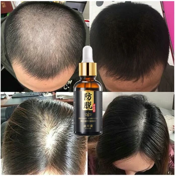 Rast vlasov essence Anti-hair loss zdravotnej starostlivosti krásy rast vlasov účinné ošetrenie vlasovej pokožky výživy, oprava poškodených starostlivosť