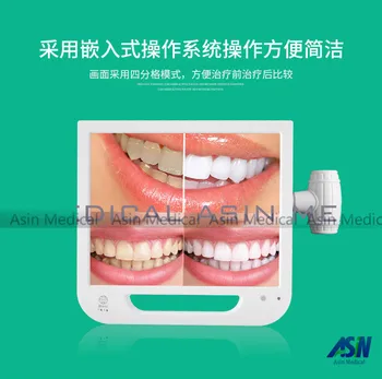Vysoká Kvalita 5.0 mega pixelov HD WIFI zubné intra-ústne kamera s LCD displejom, všetko v jednom stroj s monitorom a držiteľ 8G USB disku