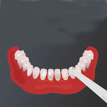 Dospelých sonická elektrická zubná kefka dve hlavy, elektrické zubné kefky, akustické vlny kefka dupont kefa hlavu zubného kameňa a počtu