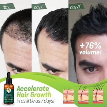 Zázvor Germinal Olej Vlasy Vyživujú Živín Kvapaliny Anti-Hair Loss Zmäkčiť Hydratačné Oprava Anti Frizz Oil Control SMJ 334