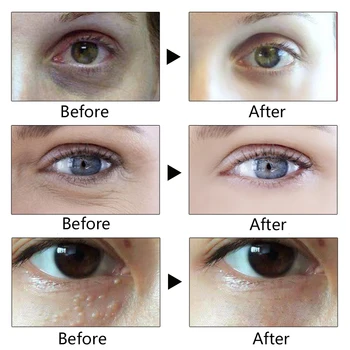 Anti-wrinkle Hydratačný Očný Krém Proti starnutiu, Tmavé Kruhy Odstránenie Očné Krémy na Spevnenie a Výťah Starostlivosť o Oči Opuchy Očné Sérum