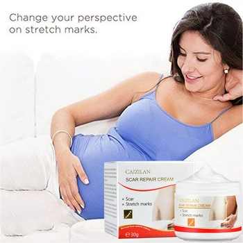 Prírodné Účinné Anti-Stretch Marks Cream Hladké Brucho Anti-Wrinkle 30g Módne Ženy, Zdravie, Krása Popôrodná Repair Cream