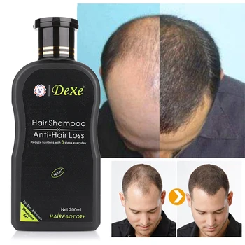 200 ml Rast Vlasov Šampón Proti vypadávaniu Vlasov Šampón opätovný rast Čínskej Bylinnej Zázvor Vlasy Repair Zabrániť Produkt Liečbu vypadávanie Vlasov