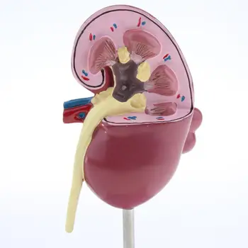 Obličky Ľudských Anatomický Model 2Sided, Normálny a s Patológií