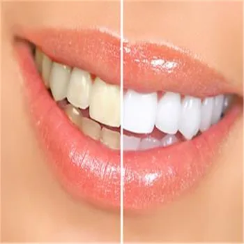 Populárne Biele Zuby Bieliace Pero Zubný Gél Whitener Bleach Odstrániť Škvrny ústnej hygieny HOT PREDAJ