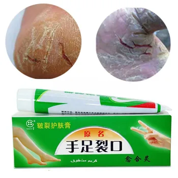 Čínsky Medicial Ruky, Nohy Crack liečba Krém na Popraskané Päty Peeling Repair Anti Suché Crack Zimné Masť Pokožky Starostlivosť o Nohy Krém