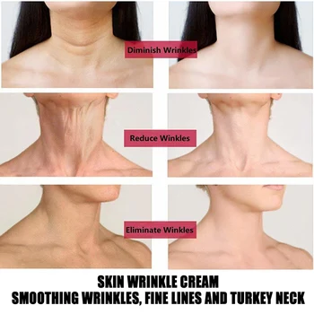 Vysoká Kvalita Skin Lightening Jemné Línie Krku Krém Proti Vráskam Zubov Spevnenie Krku Maska Pre Starostlivosť O Pleť Pre Ženy